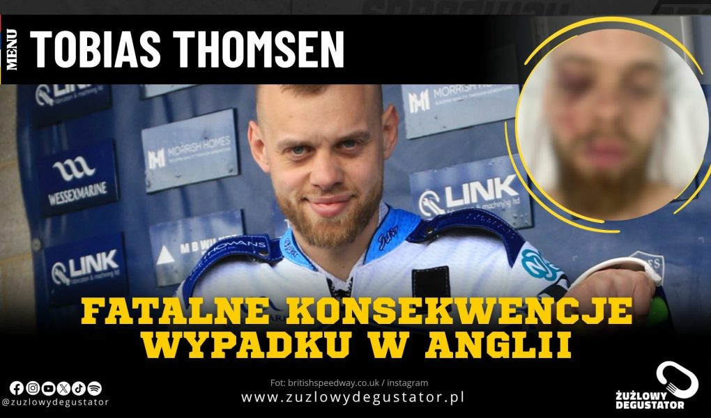 Ogromne konsekwencje wypadku Tobiasa Thomsena. Złamana kość udowa i krwotok mózgu 661032293_1488159736254619_1995047760369955510_n